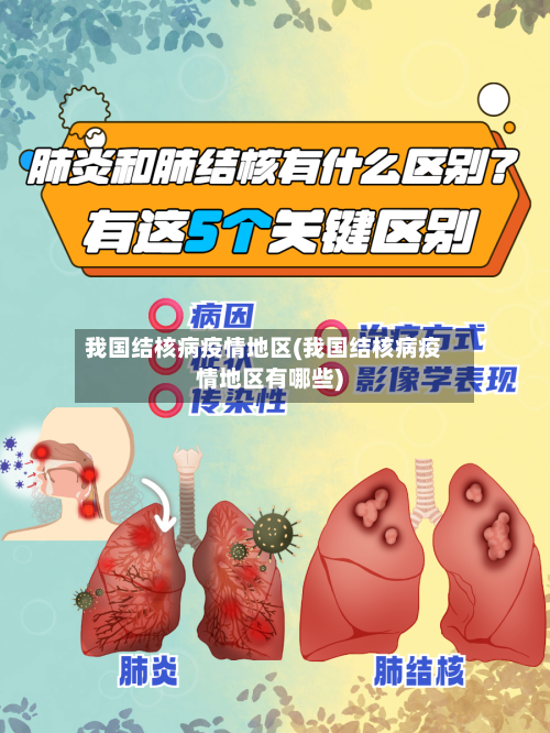 我国结核病疫情地区(我国结核病疫情地区有哪些)